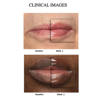 Peptide Pout
